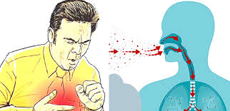 क्षयरोग भनेको के हो ? यसको रोकथाम तथा नियन्त्रणका उपायहरु